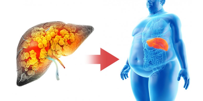 Liver 101: How Its Health Directly Impacts Your Weight