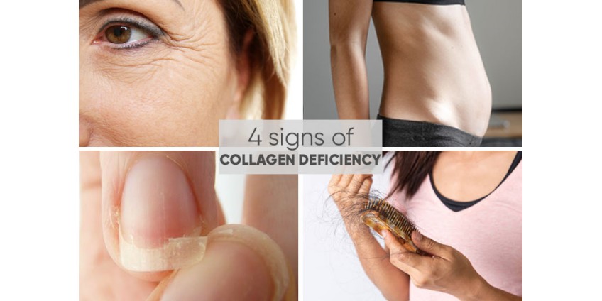 The Hidden Truth About Collagen Deficiency